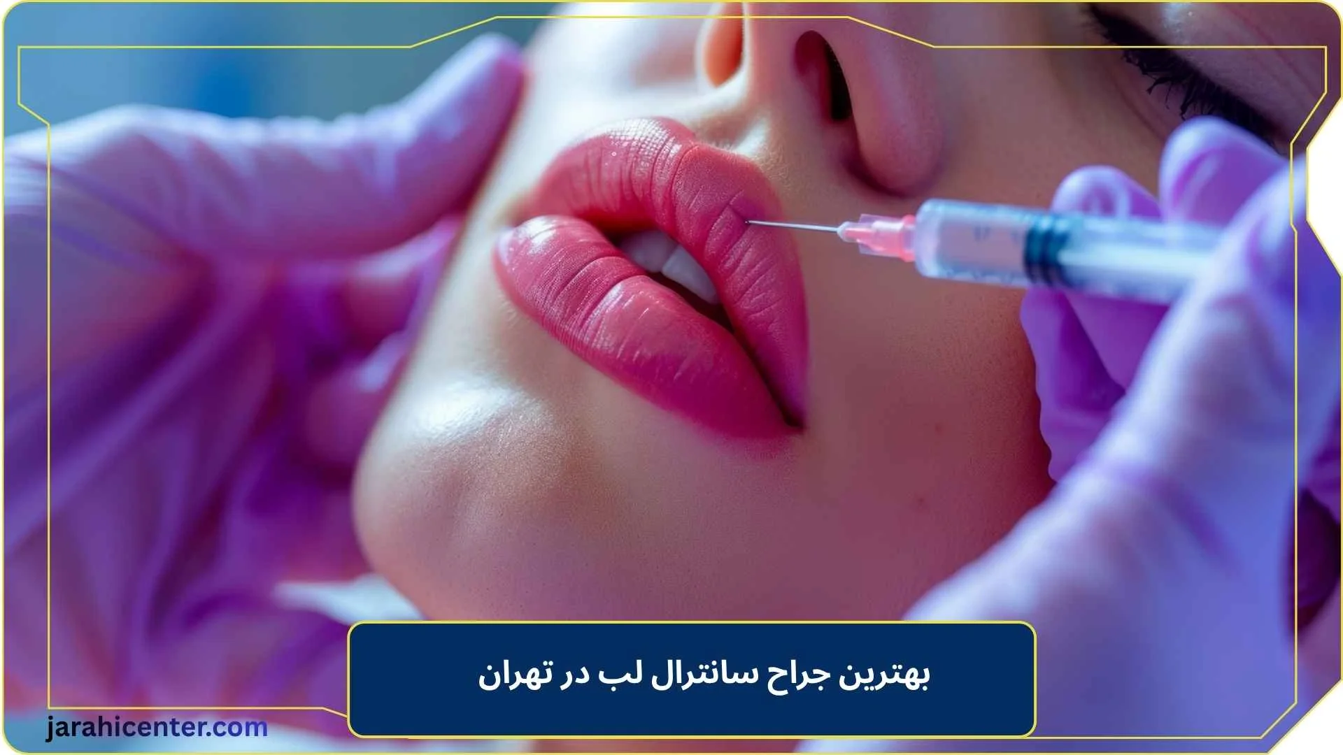 بهترین جراح سانترال لب در تهران