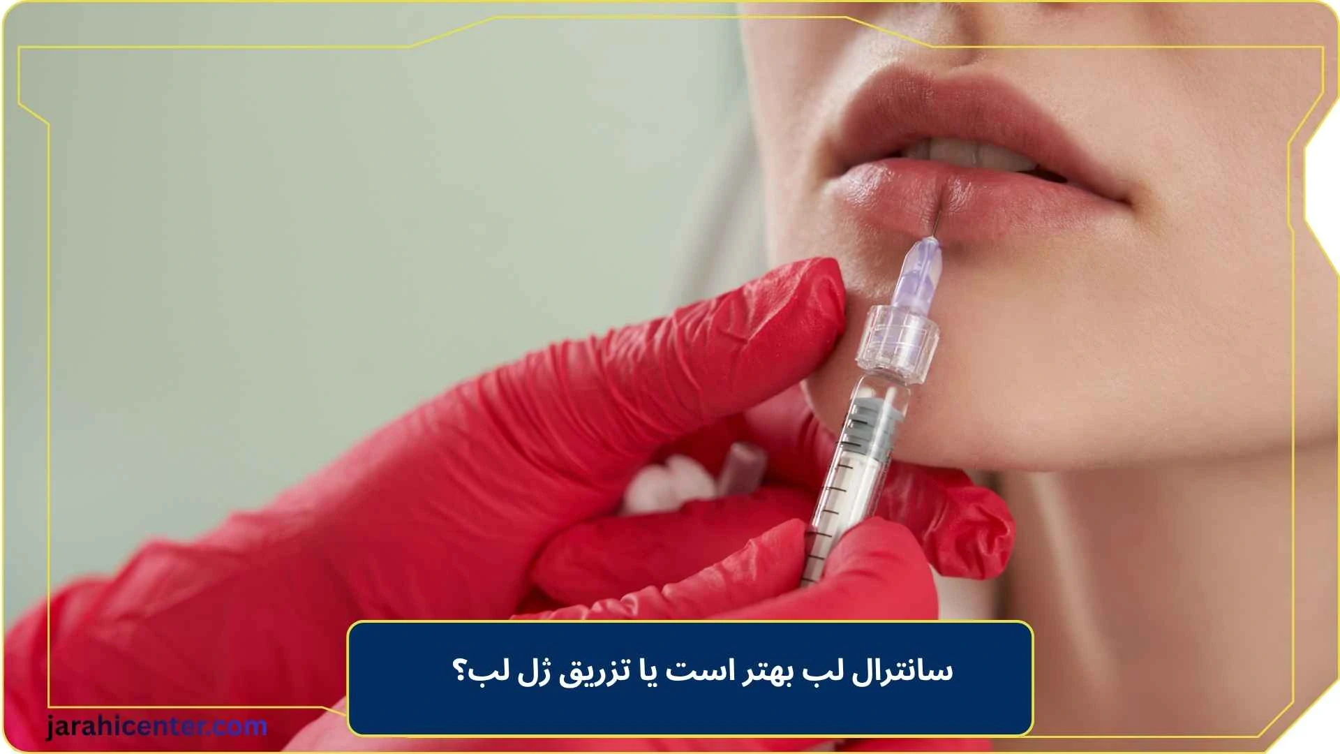 سانترال لب بهتر است یا تزریق ژل لب؟