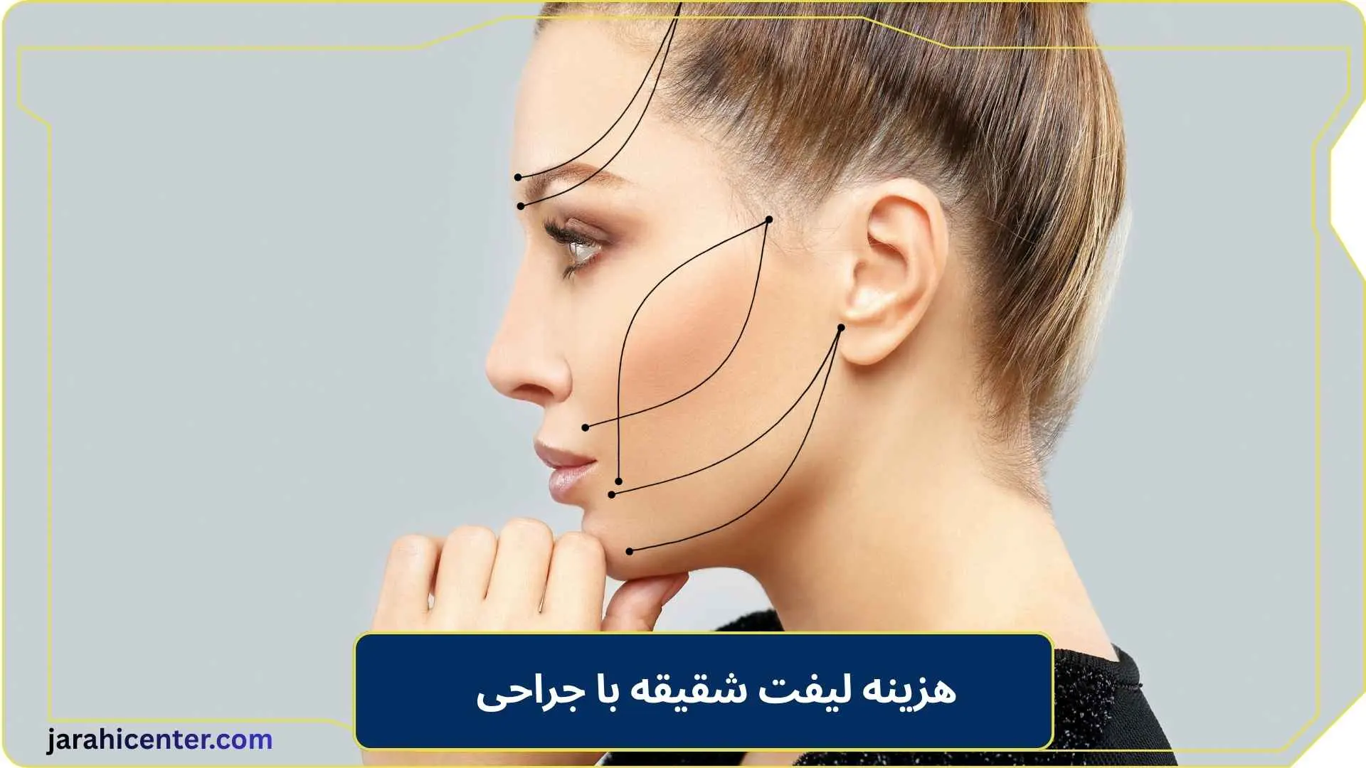هزینه لیفت شقیقه با جراحی