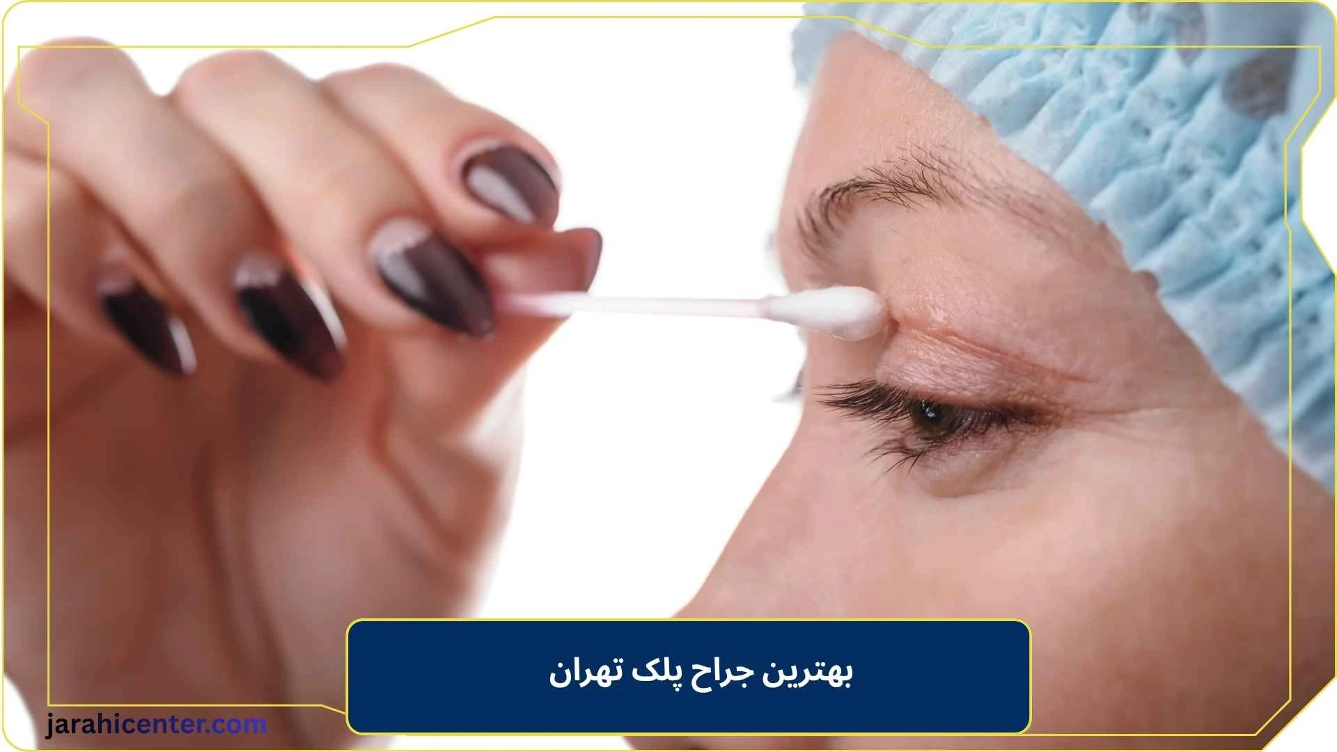 بهترین جراح پلک تهران