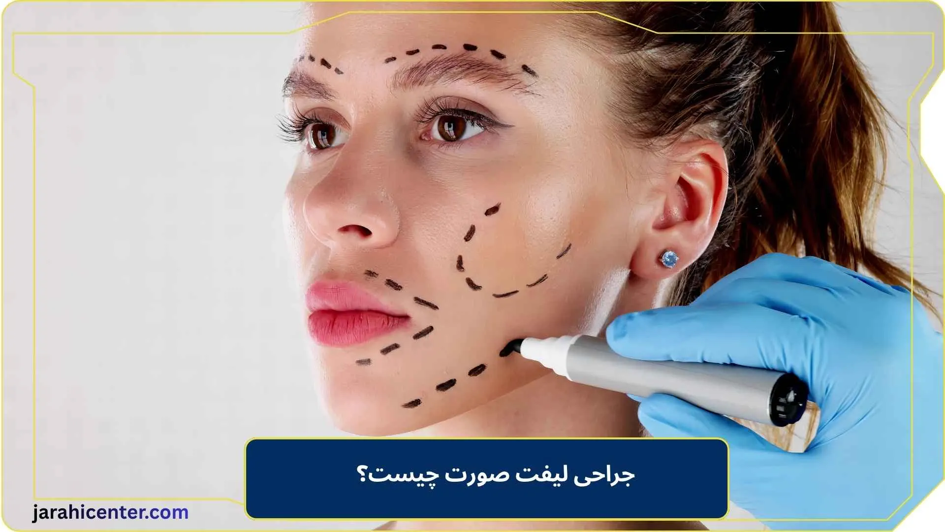 جراحی لیفت صورت چیست؟
