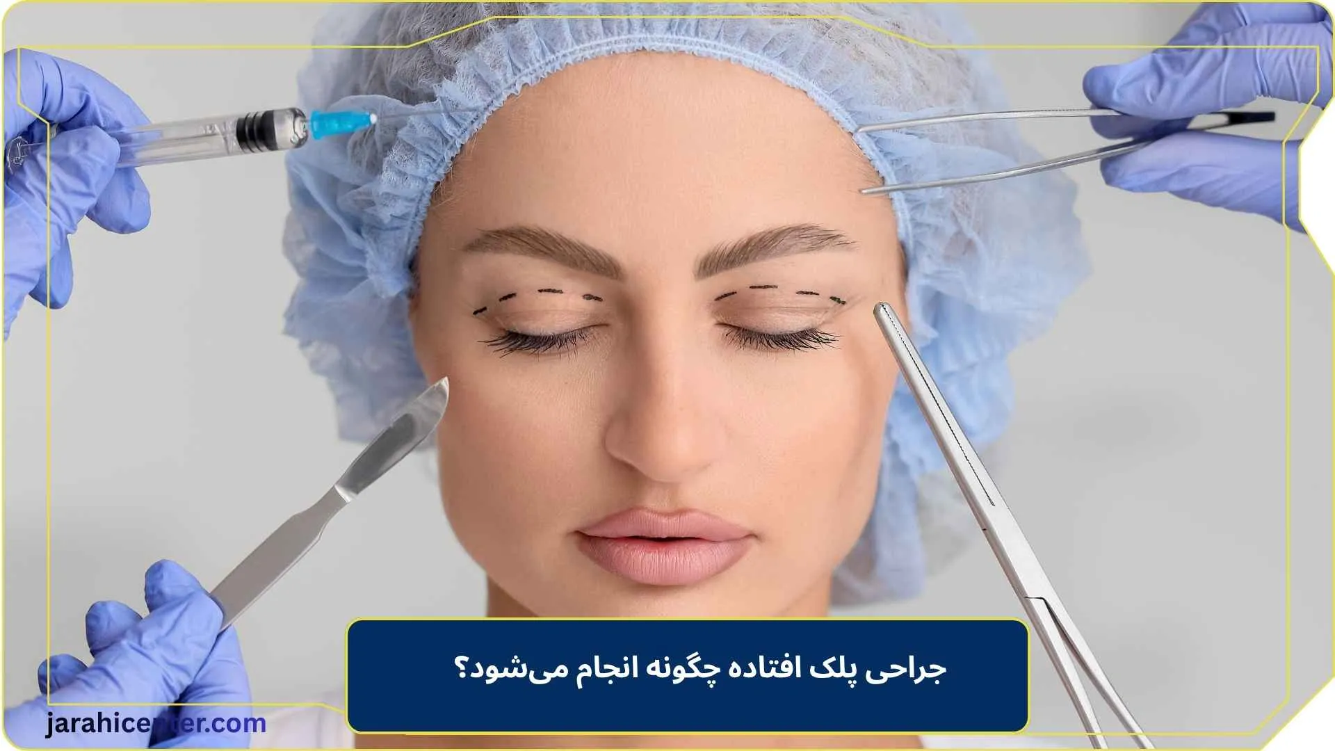 جراحی پلک افتاده چگونه انجام می‌شود؟