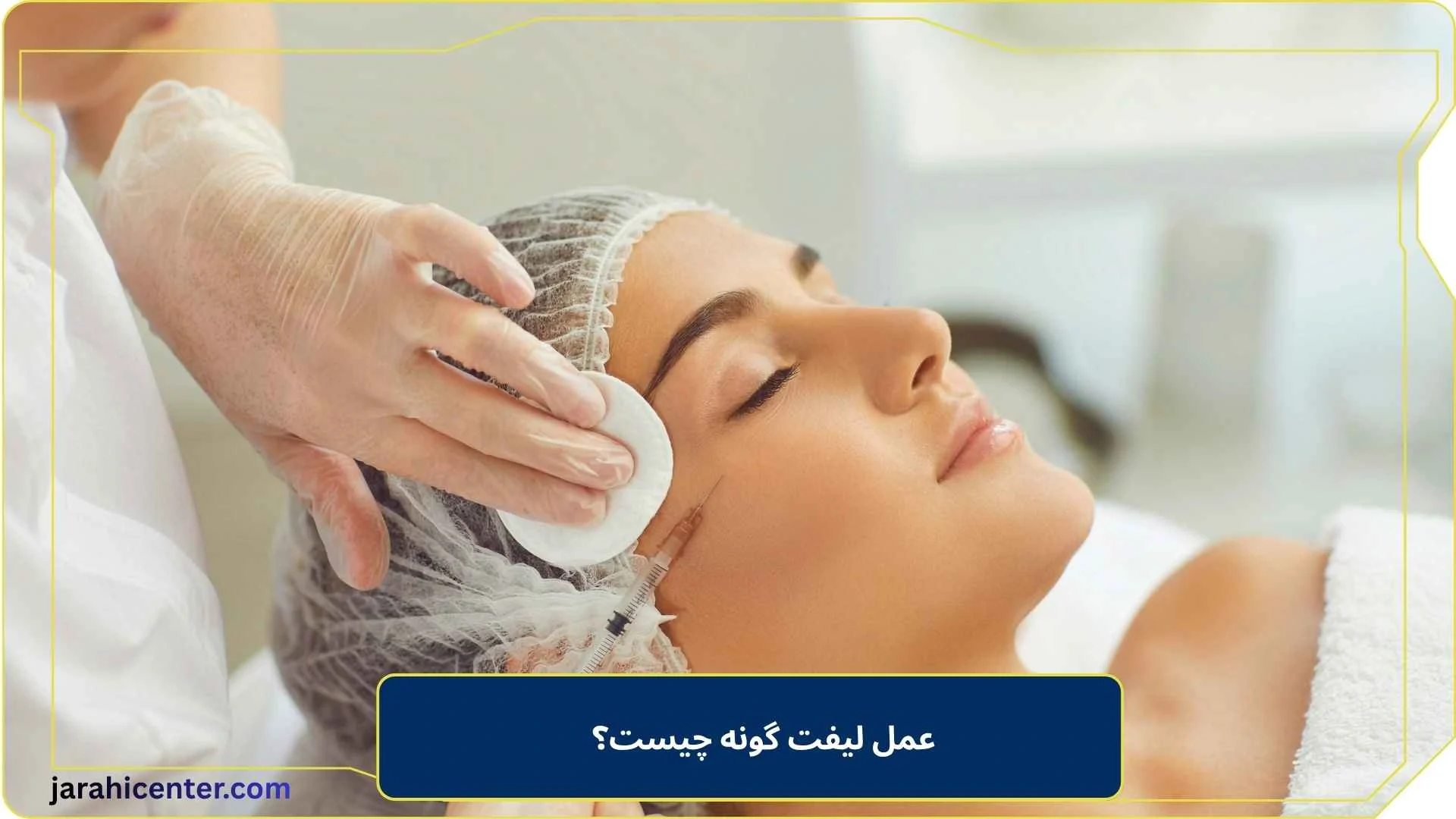 عمل لیفت گونه چیست؟