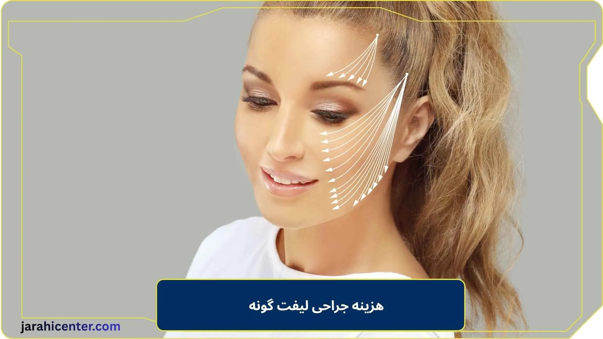 هزینه جراحی لیفت گونه