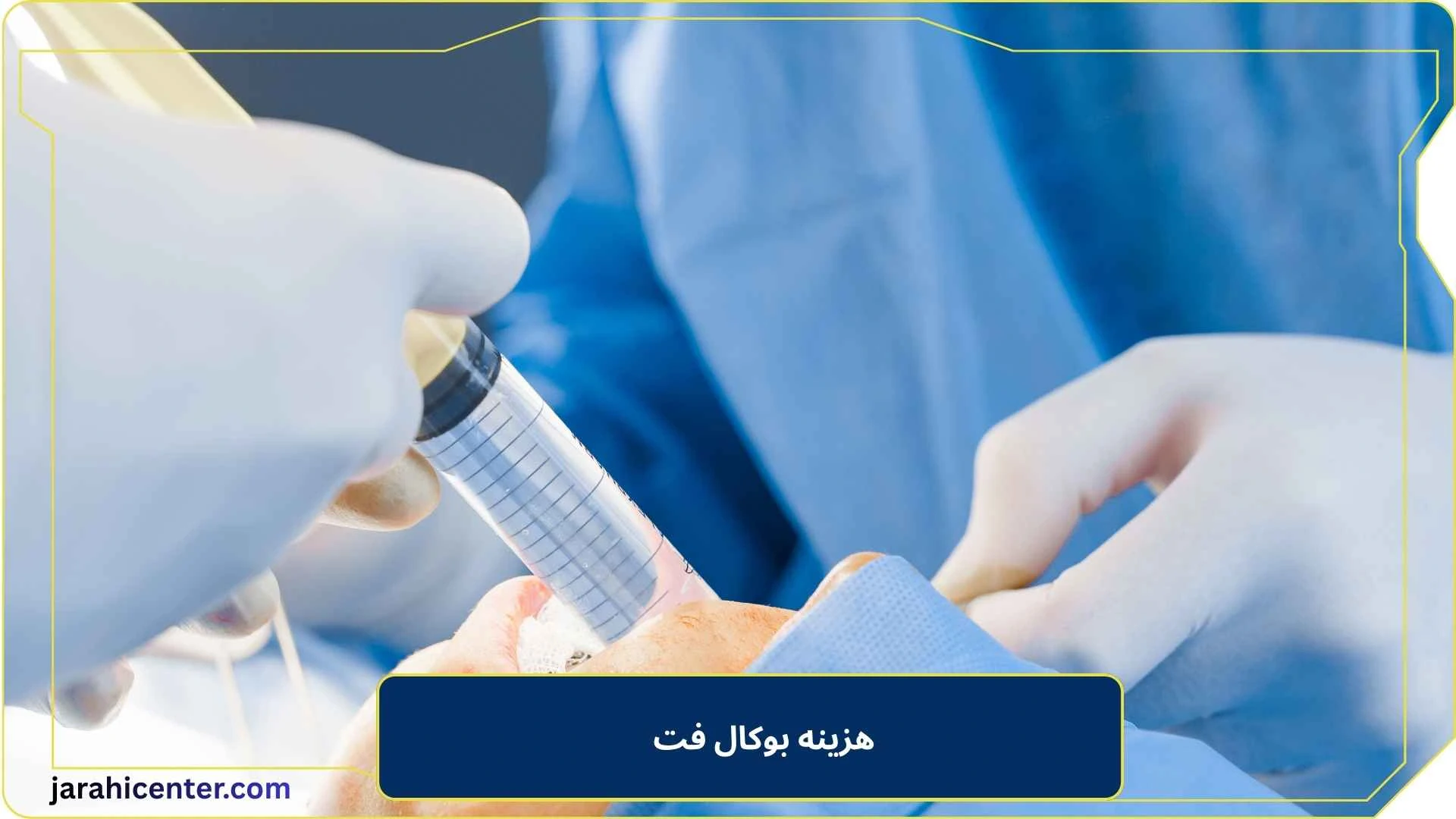 هزینه بوکال فت