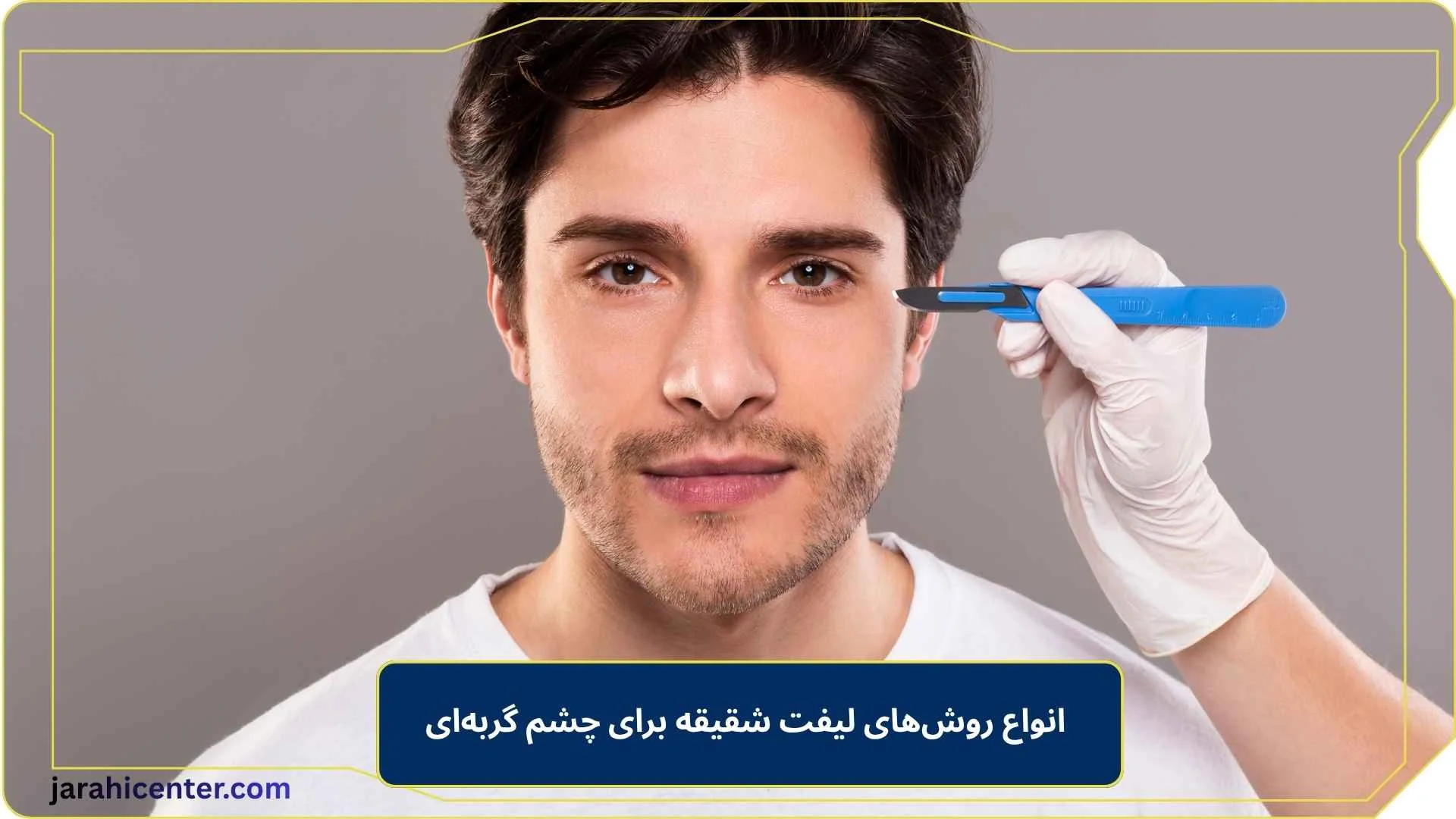 انواع روش‌های لیفت شقیقه برای چشم گربه‌ای