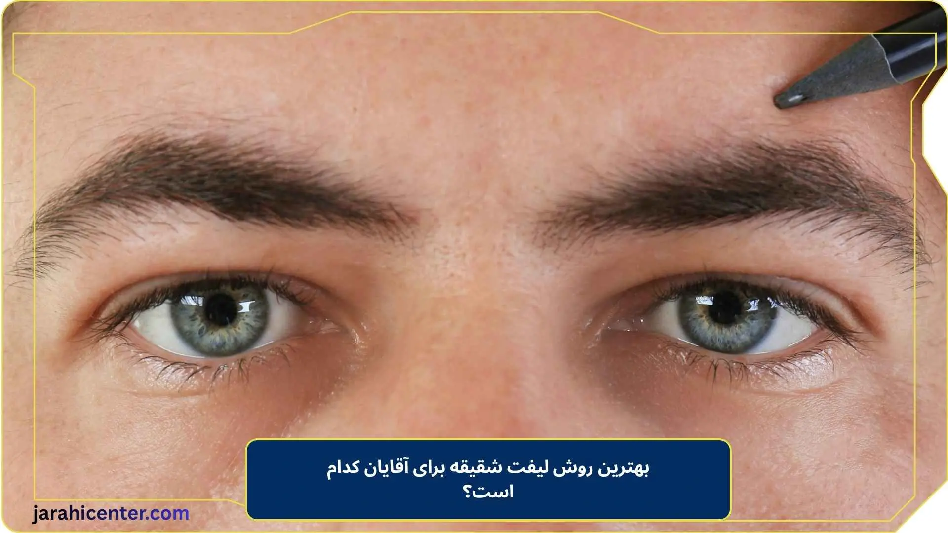 بهترین روش لیفت شقیقه برای آقایان کدام است؟