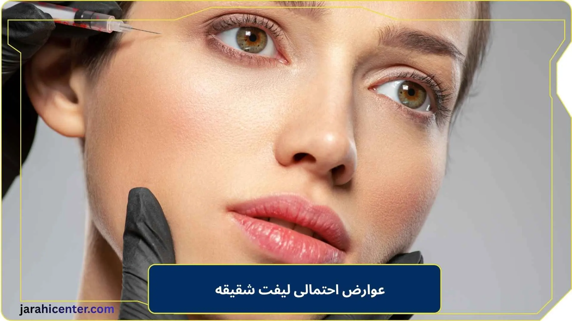 عوارض احتمالی لیفت شقیقه