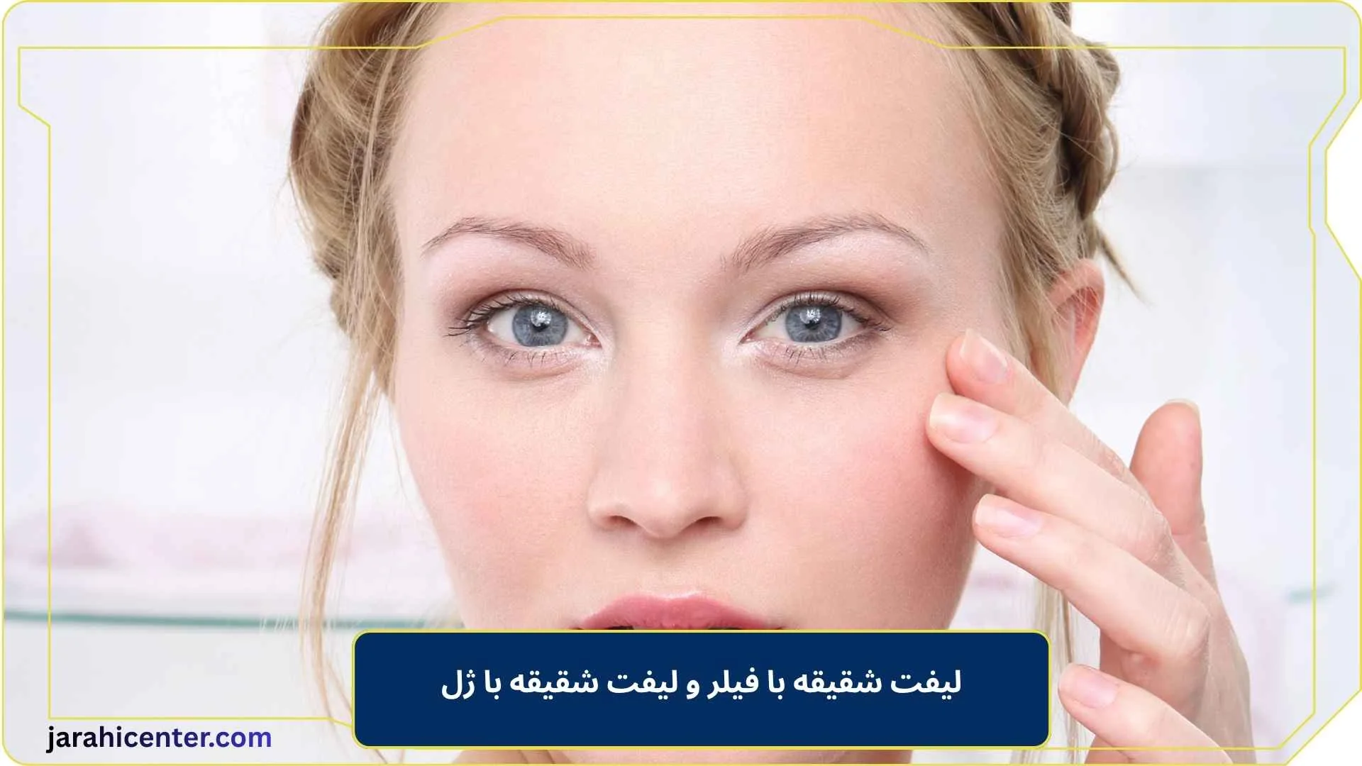 لیفت شقیقه با فیلر و لیفت شقیقه با ژل