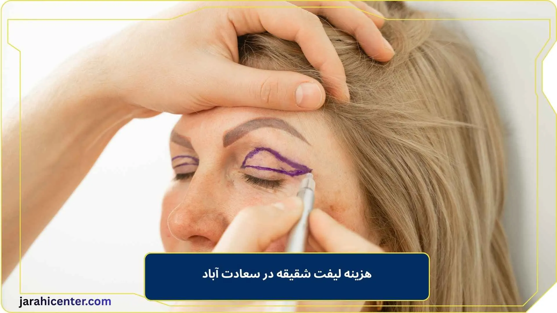 هزینه لیفت شقیقه در سعادت آباد