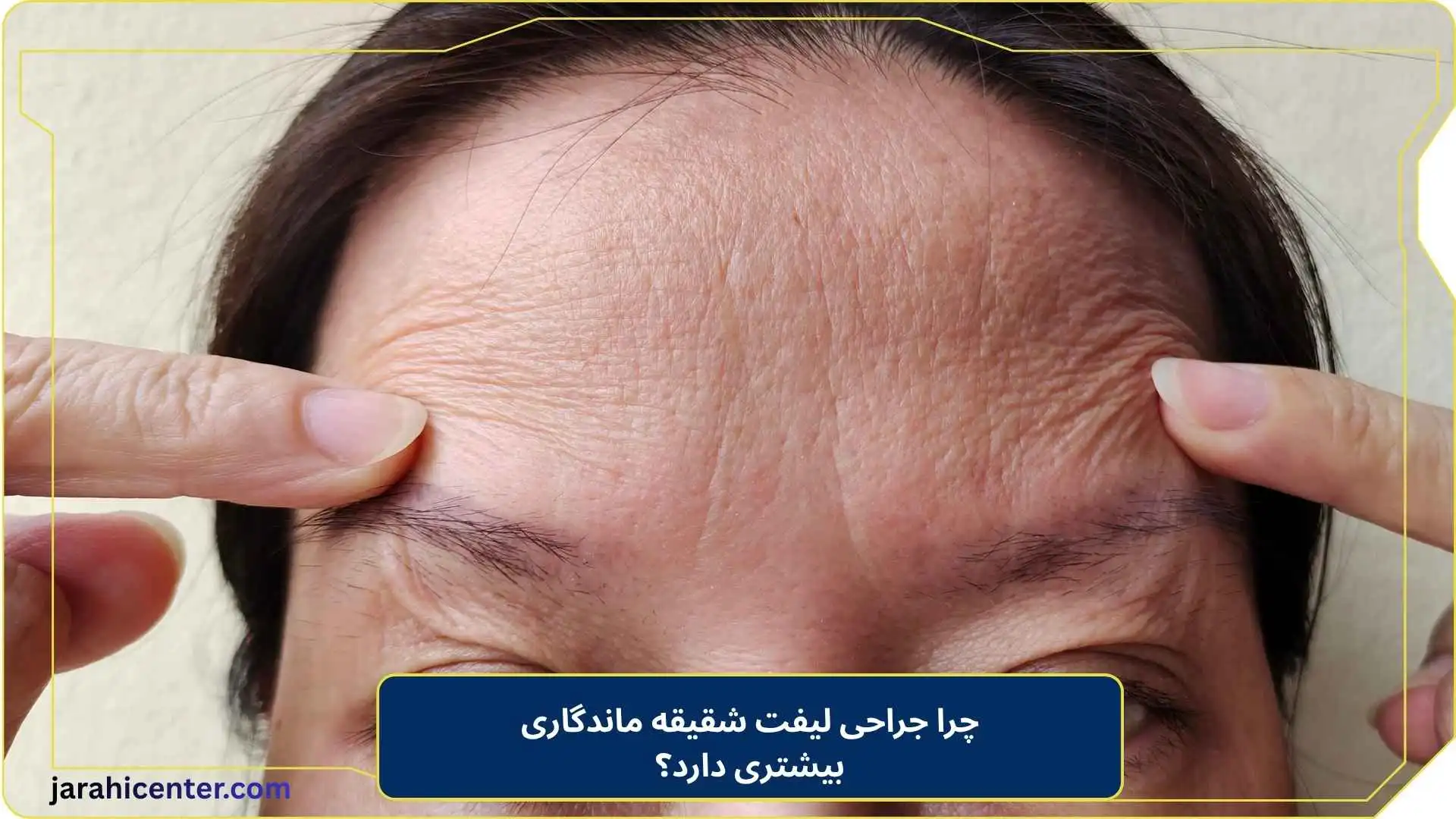 چرا جراحی لیفت شقیقه ماندگاری بیشتری دارد؟