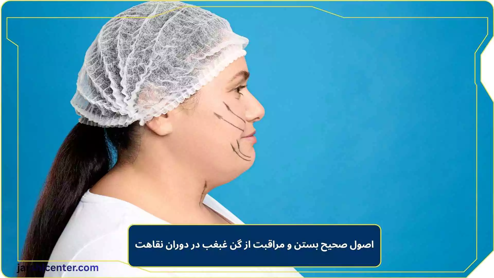 اصول صحیح بستن و مراقبت از گن غبغب در دوران نقاهت
