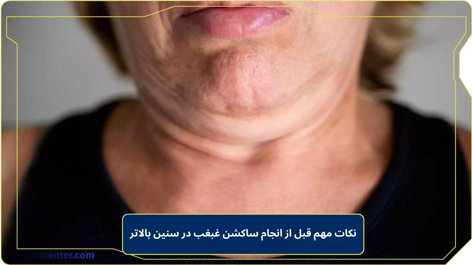 نکات مهم قبل از انجام ساکشن غبغب در سنین بالاتر