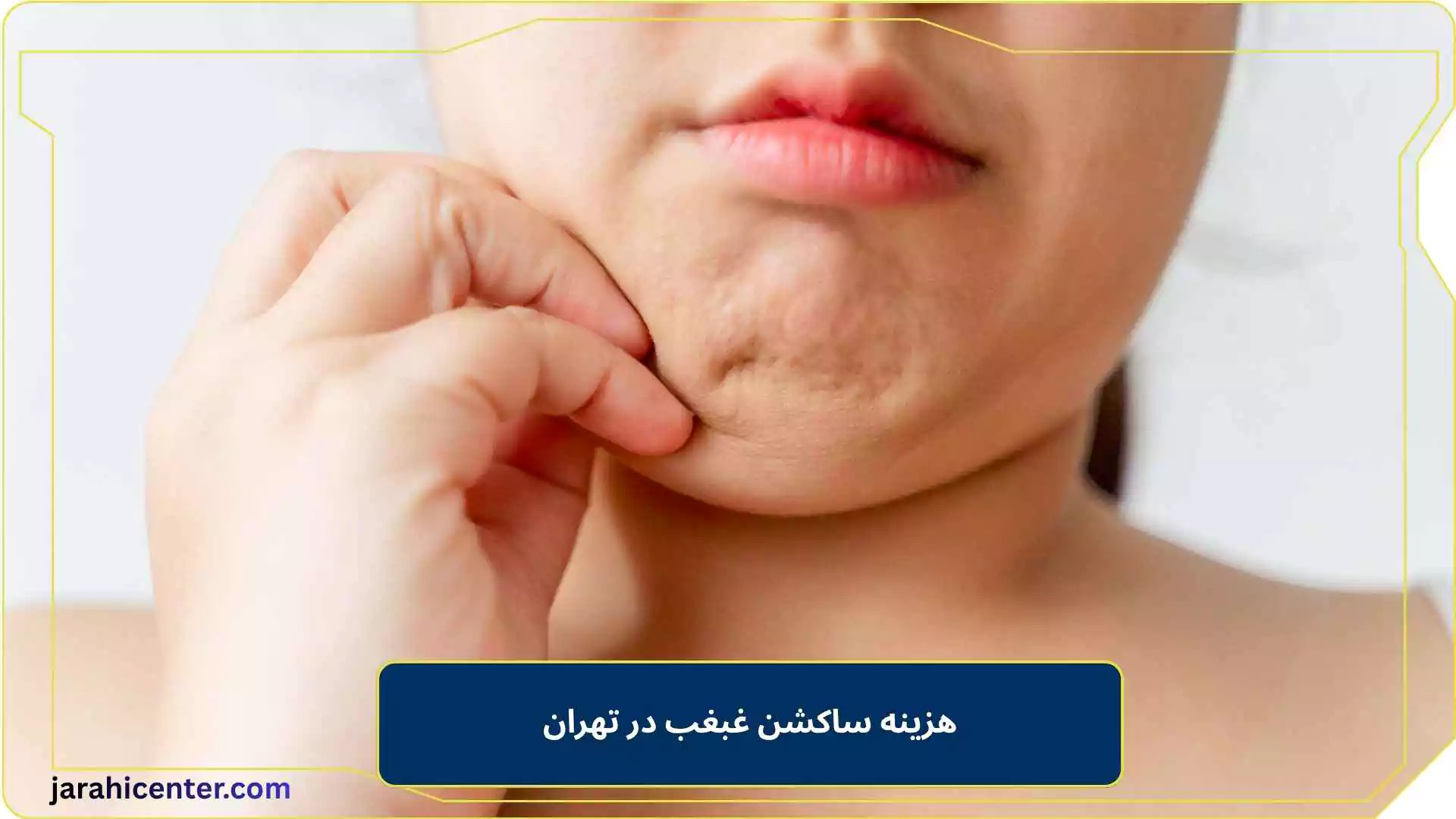 هزینه ساکشن غبغب در تهران