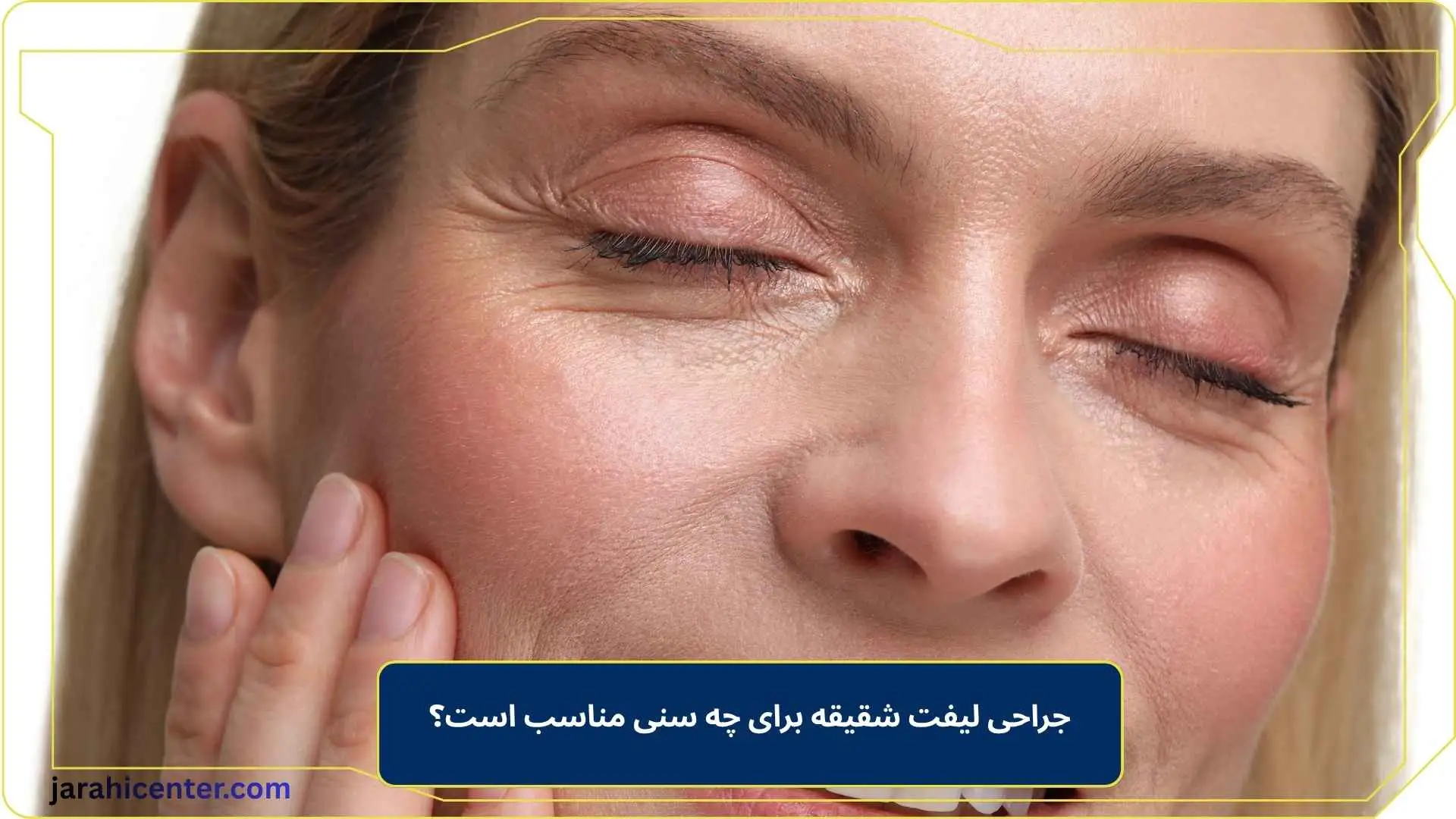 جراحی لیفت شقیقه برای چه سنی مناسب است؟