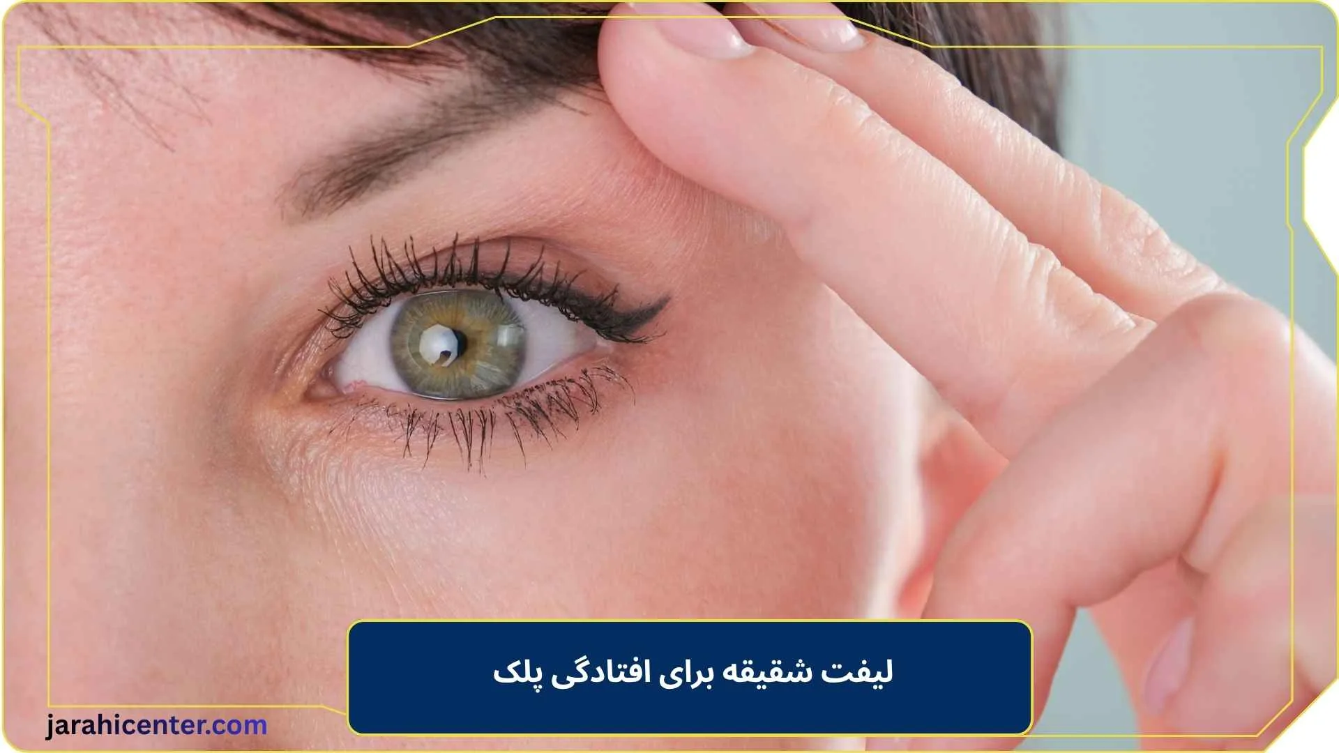 لیفت شقیقه برای افتادگی پلک 