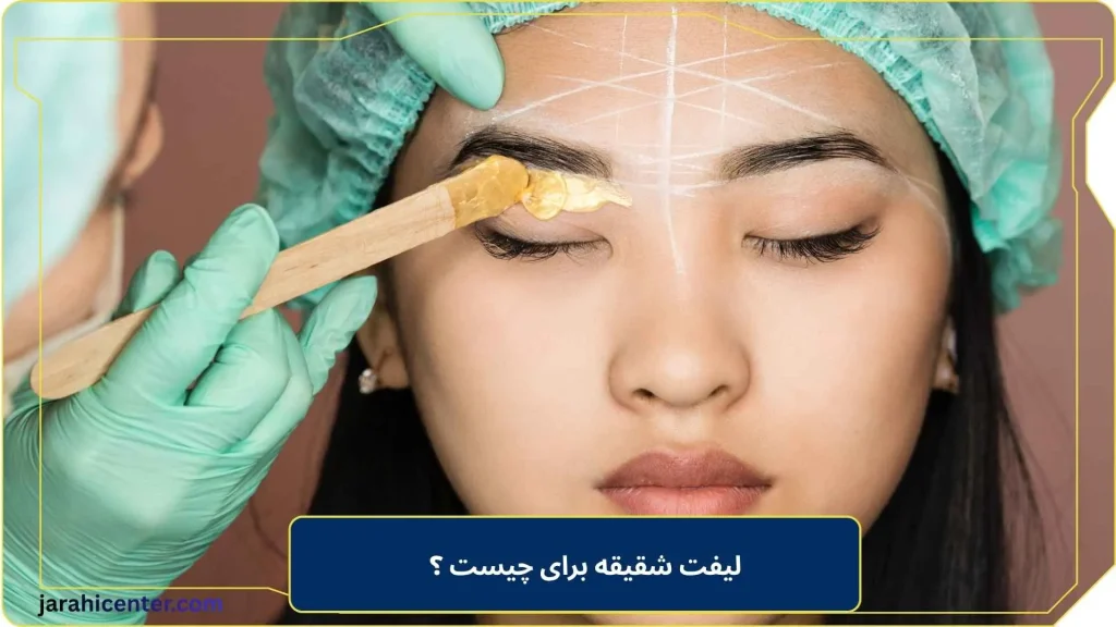 لیفت شقیقه برای چیست ؟