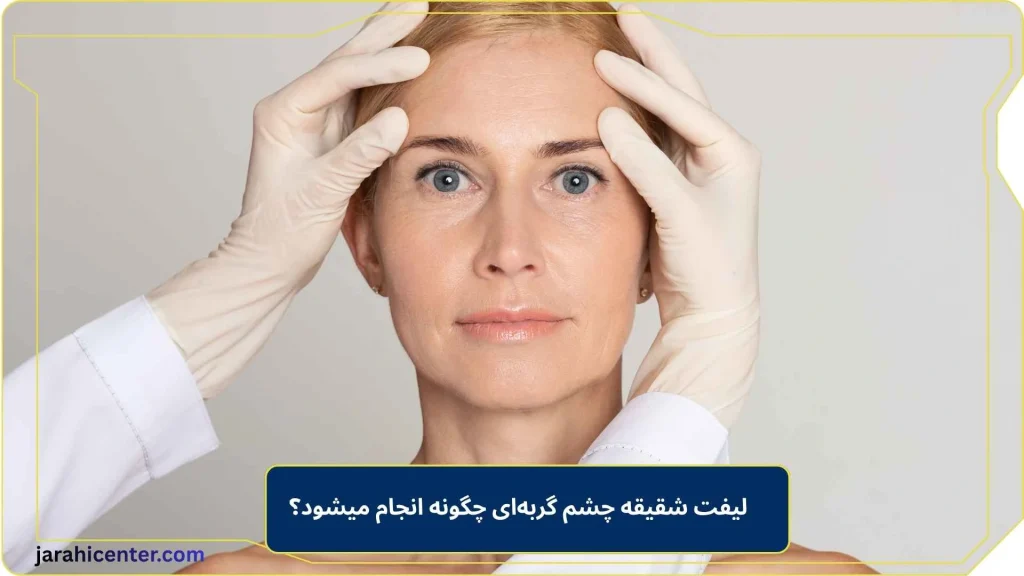 لیفت شقیقه چشم گربه‌ای چگونه انجام میشود؟