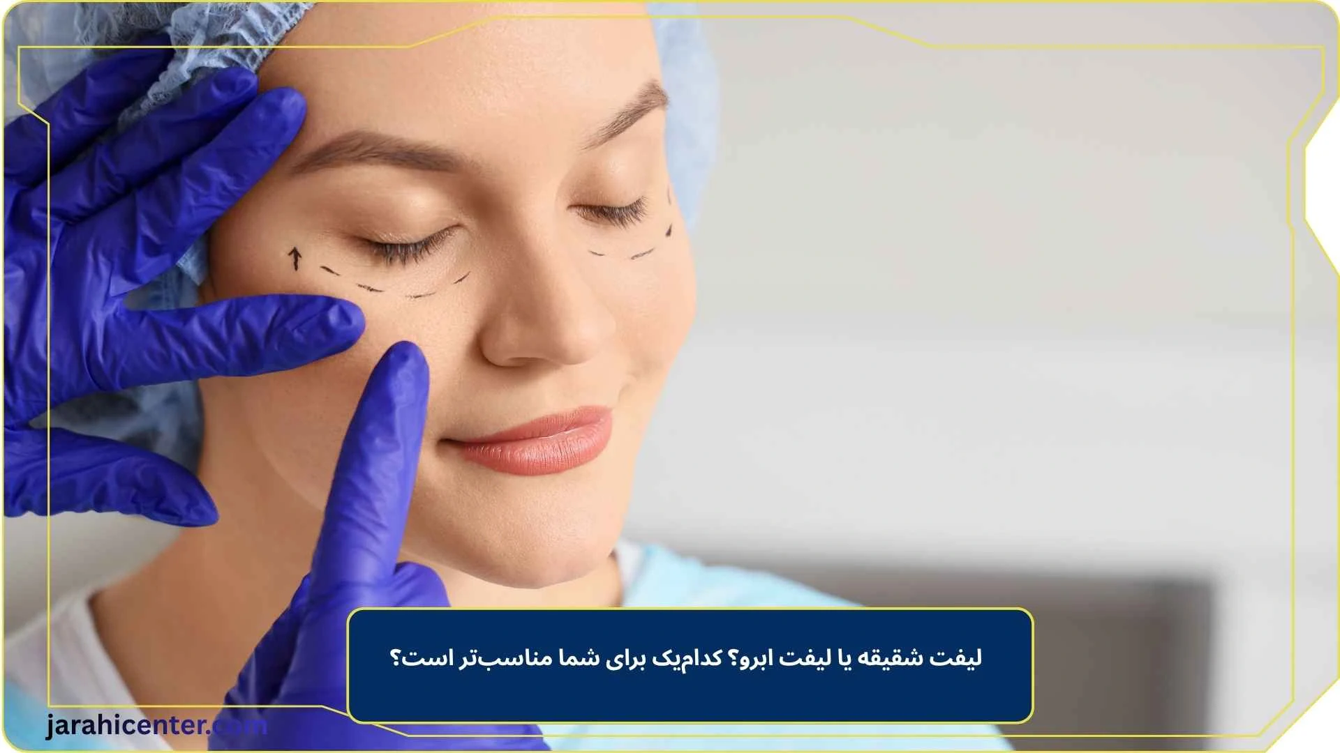 لیفت شقیقه یا لیفت ابرو؟ کدام‌یک برای شما مناسب‌تر است؟