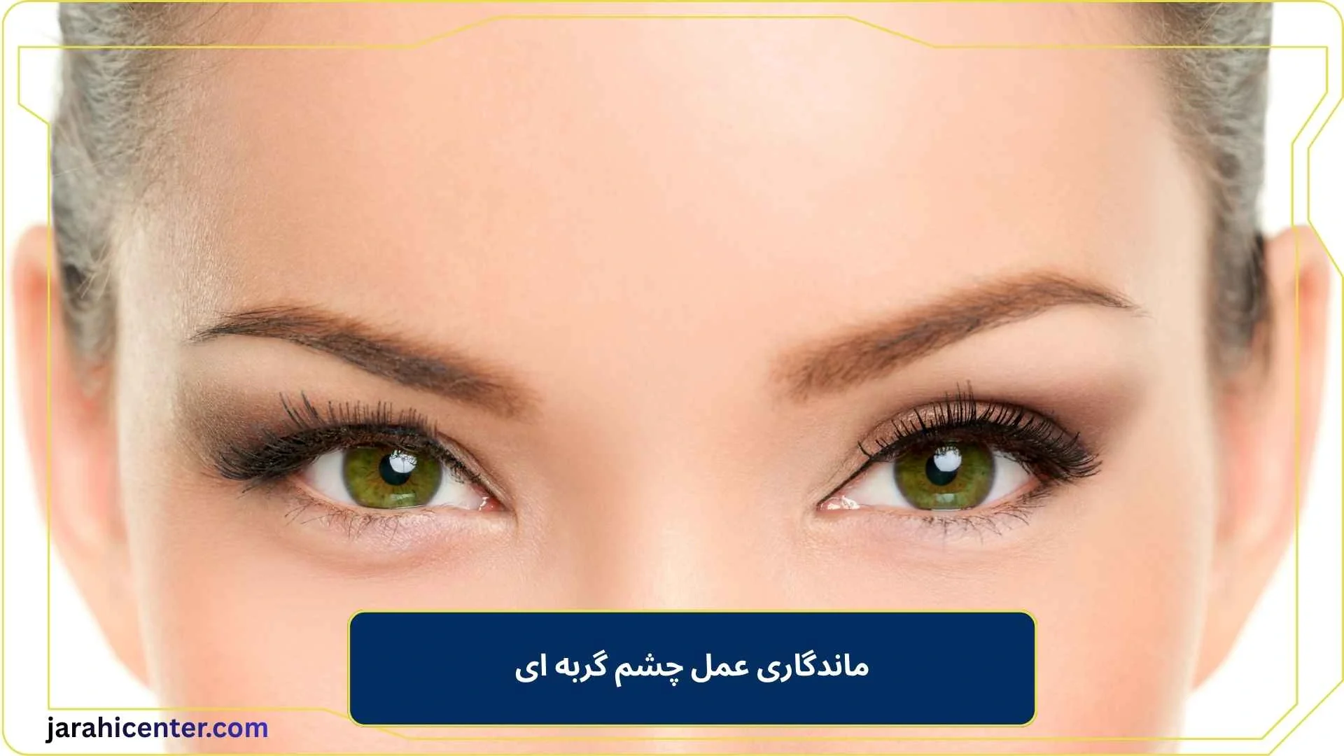 ماندگاری عمل چشم گربه ای