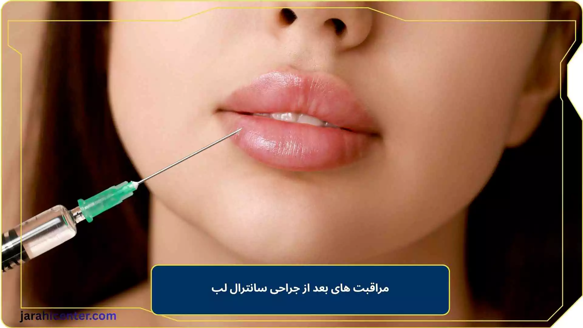 مراقبت های بعد از جراحی سانترال لب